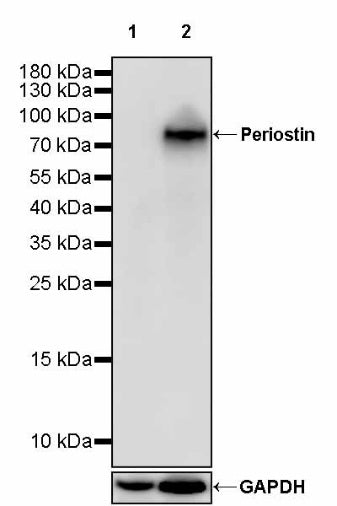Periostin Recombinant Rabbit mAb (S-2824-17)