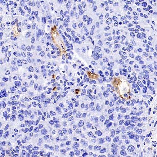 NaPi2b/SLC34A2 Recombinant Rabbit mAb (SDT-R229)