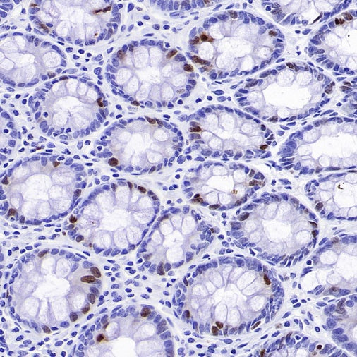 TOP2A Recombinant Rabbit mAb (S-513-107)