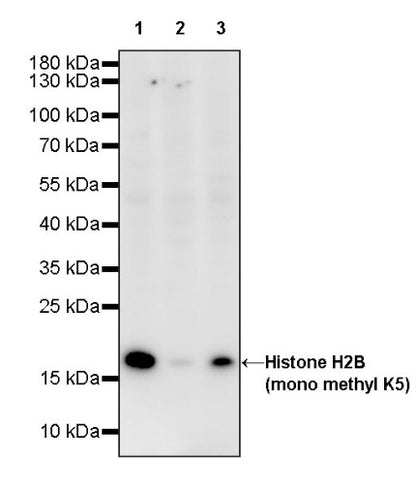 Histone H2B (mono methyl K5) Recombinant Rabbit mAb (S-1416-412)