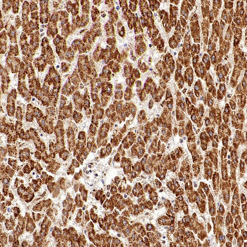 ATPB Rabbit Polyclonal Antibody