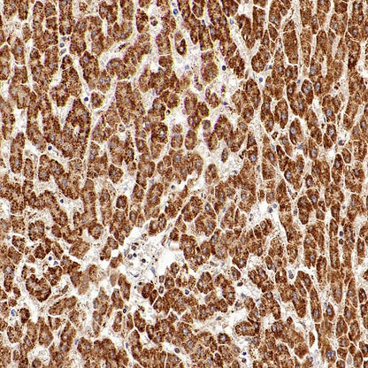 ATPB Rabbit Polyclonal Antibody