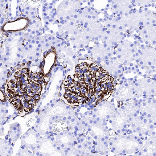 Vimentin Recombinant Rabbit mAb (SDT-029-120)