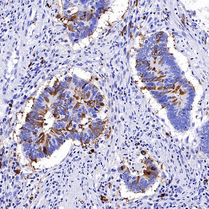 TACC3 Recombinant Rabbit mAb (S-3048-50)