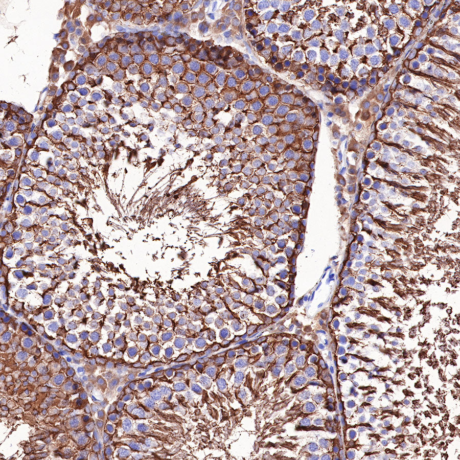 Beta III tubulin Recombinant Rabbit mAb (SDT-251-28)