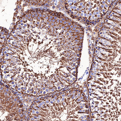 Beta III tubulin Recombinant Rabbit mAb (SDT-251-28)