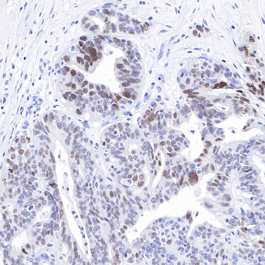 SOX9 Recombinant Rabbit mAb (SDT-019-29)