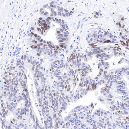 SOX9 Recombinant Rabbit mAb (SDT-019-29)