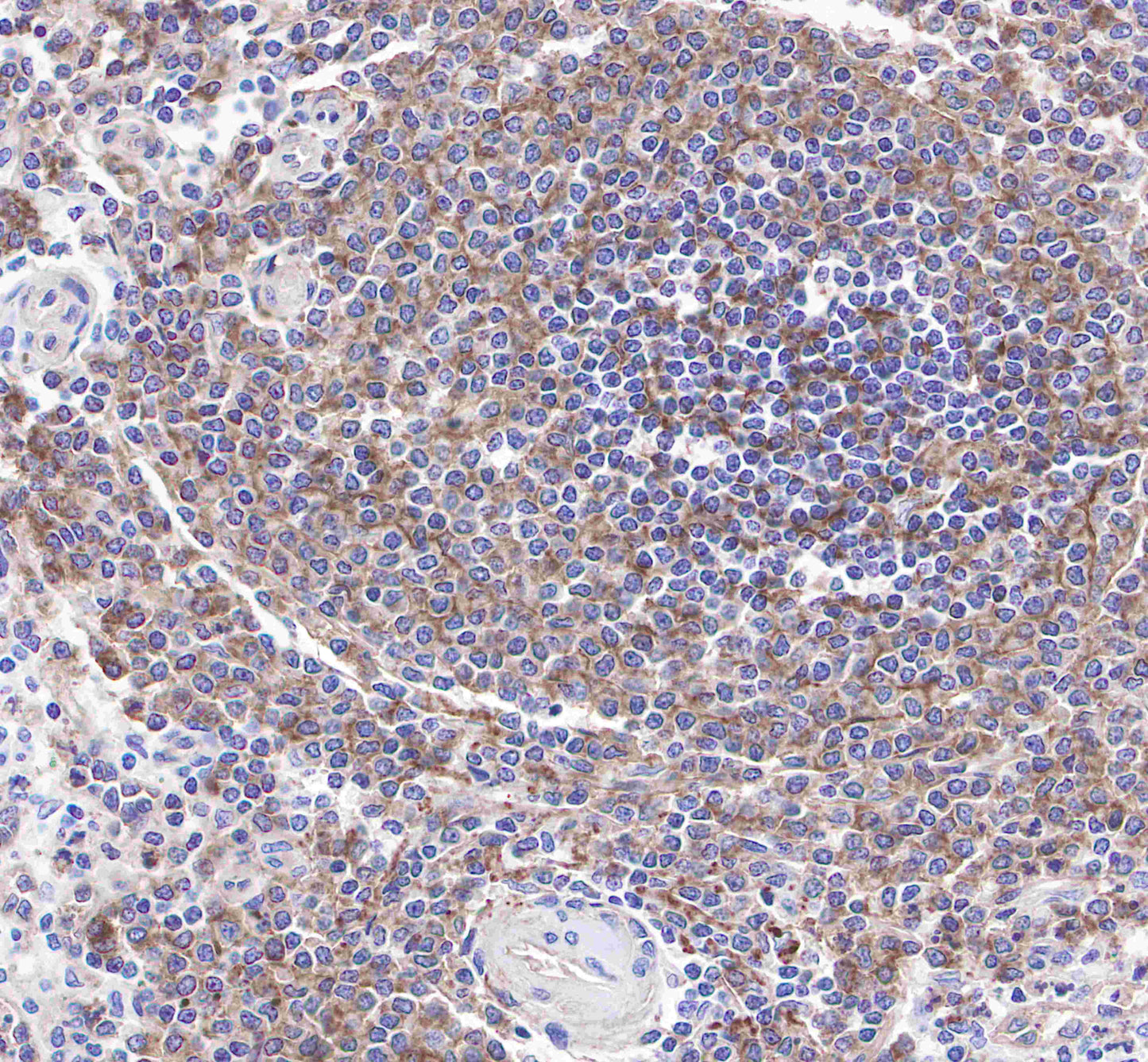 CD21 Recombinant Rabbit mAb,PBS Only (SDT-007-36)