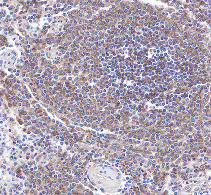 CD21 Recombinant Rabbit mAb,PBS Only (SDT-007-36)