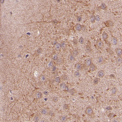 LC3B Recombinant Rabbit mAb (S-1599-142)