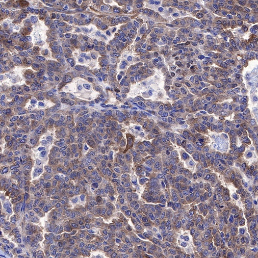 NF-κB p65 Recombinant Rabbit mAb (S-475-56)