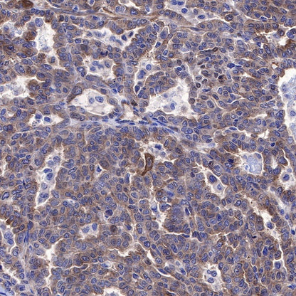 NF-κB p65 Recombinant Rabbit mAb (S-475-56)