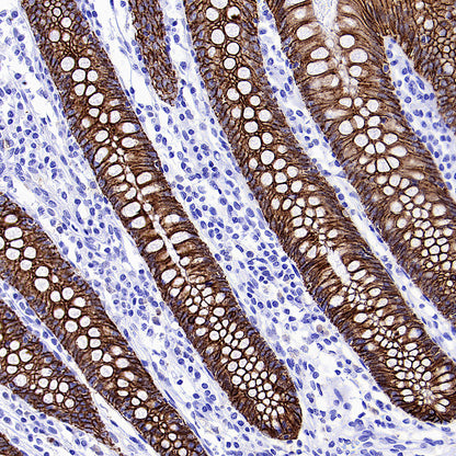 CDH17 Recombinant Rabbit mAb (SDT-3276-11)