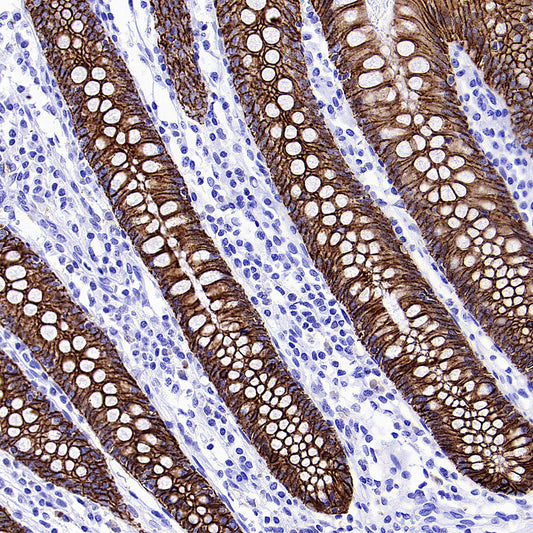 CDH17 Recombinant Rabbit mAb (SDT-3276-11)