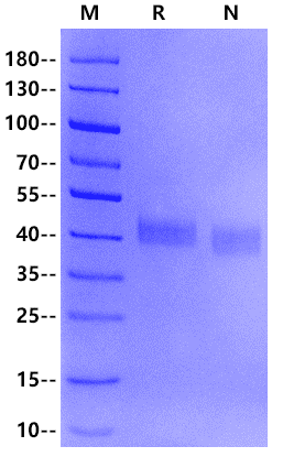 Envelope Glycoprotein D (gD) His Tag Protein, HSV-2 (strain 333)