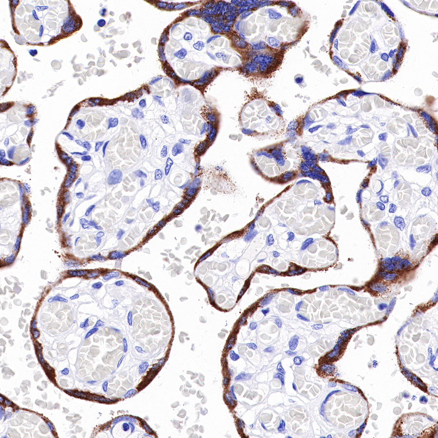 CGA/HCG-α Recombinant Rabbit mAb (SDT-227-66)