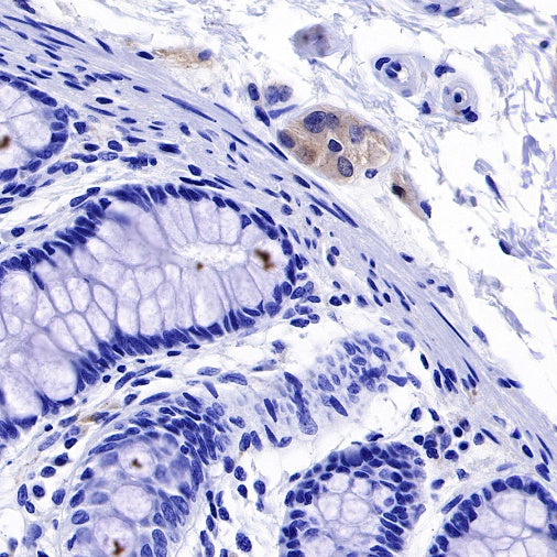 α-Synuclein Recombinant Rabbit mAb (S-441-86)