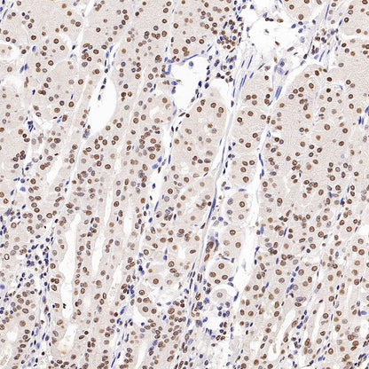 Histone H3 (mono methyl K79) Recombinant Rabbit mAb (S-R417)