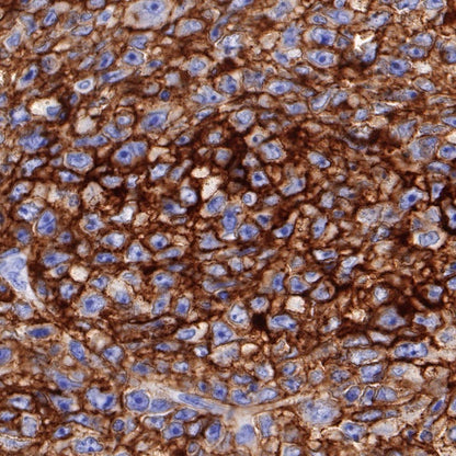 CD80 Recombinant Rabbit mAb (S-288-154)