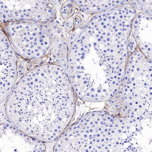 TMEM119 Recombinant Rabbit mAb (S-1040-14)