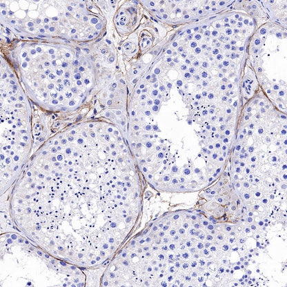 TMEM119 Recombinant Rabbit mAb (S-1040-14)