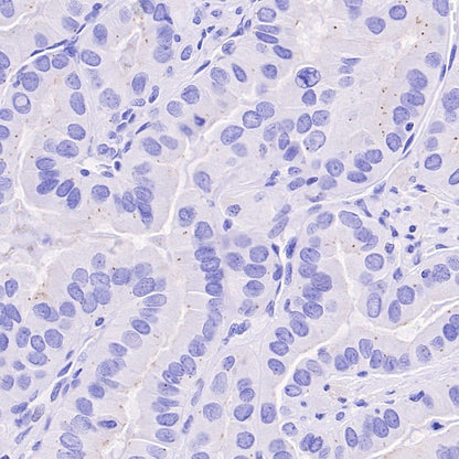 Pericentrin Recombinant Rabbit mAb (S-3493)