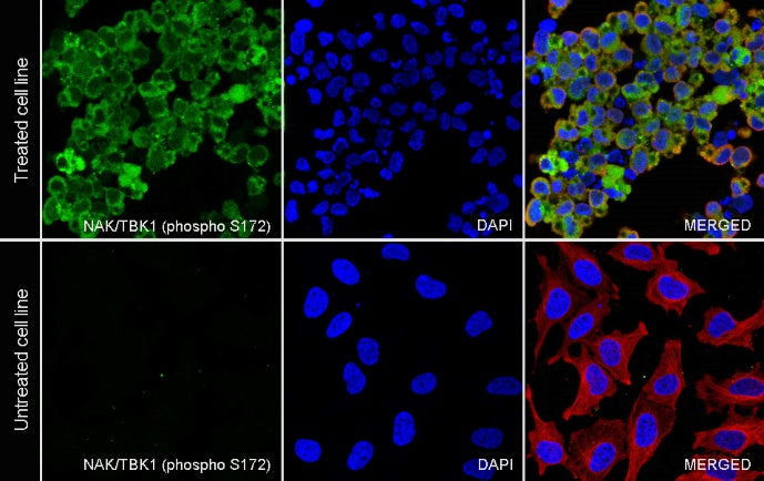 Phospho-NAK/TBK1 (Ser172) Recombinant Rabbit mAb (S-2481-14)