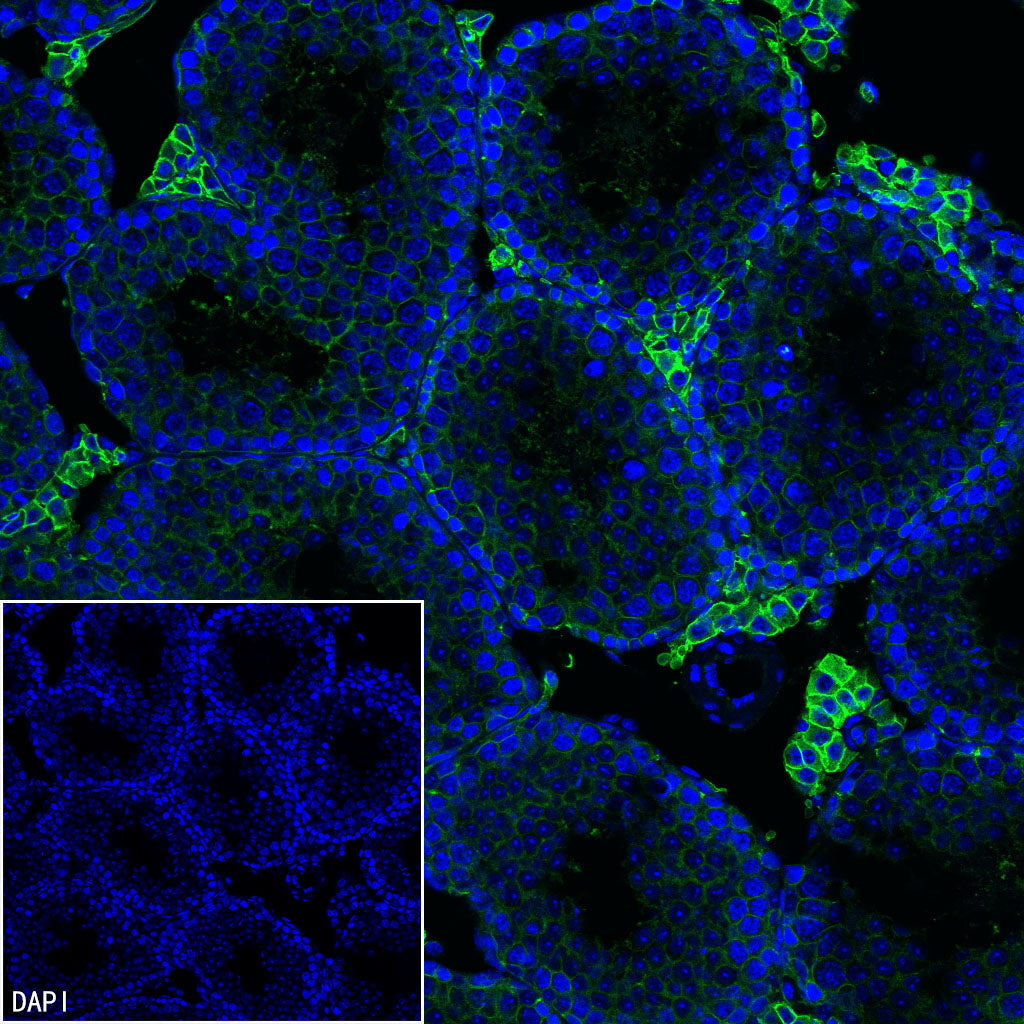 SLC7A5 Recombinant Rabbit mAb (S-4496-55)