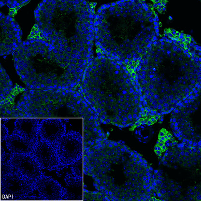 SLC7A5 Recombinant Rabbit mAb (S-4496-55)