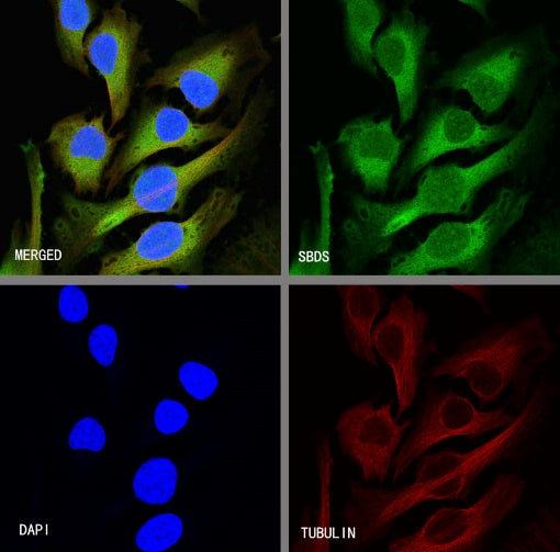 SBDS Recombinant Rabbit mAb (S-R344)