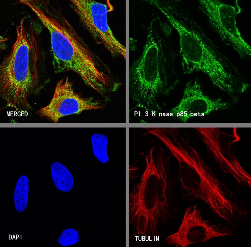 PI3 Kinase p85 beta Recombinant Rabbit mAb (S-1058-266)