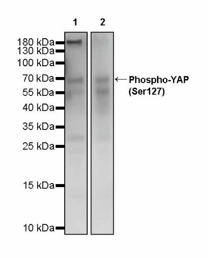 Phospho-YAP (Ser127) Recombinant Rabbit mAb (S-4250)