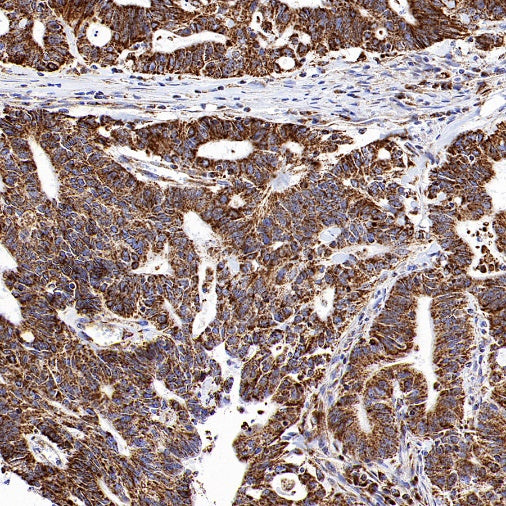 VDAC1 Recombinant Rabbit mAb (S-1877-18)