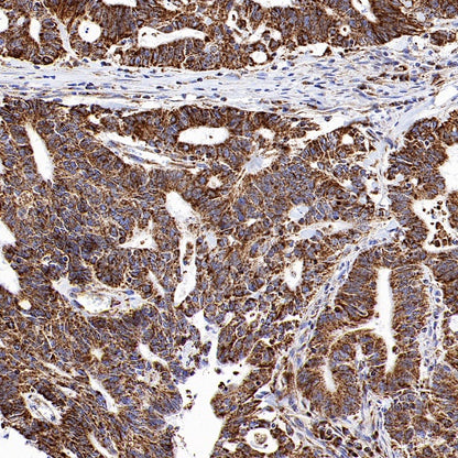 VDAC1 Recombinant Rabbit mAb (S-1877-18)