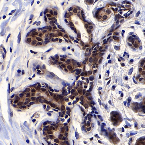 PDCD6 Recombinant Rabbit mAb (S-578-98)