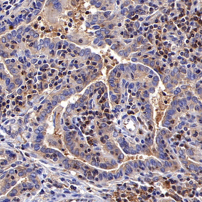 NF-κB p105/p50 Rabbit polyclonal antibody