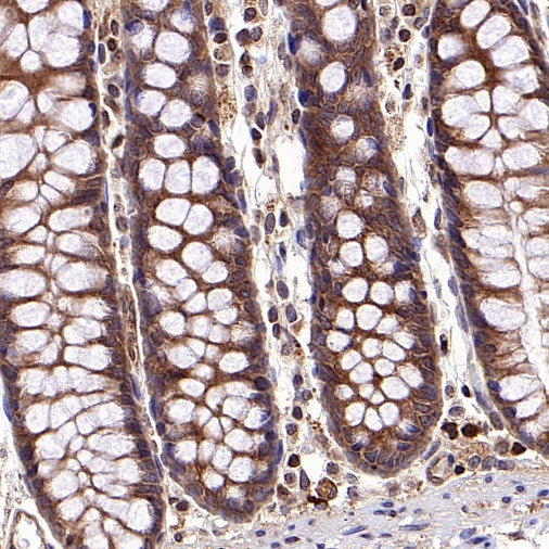 NF-κB p105/p50 Rabbit polyclonal antibody