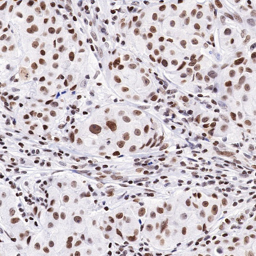 HMGB1 Recombinant Rabbit mAb (S-R305)