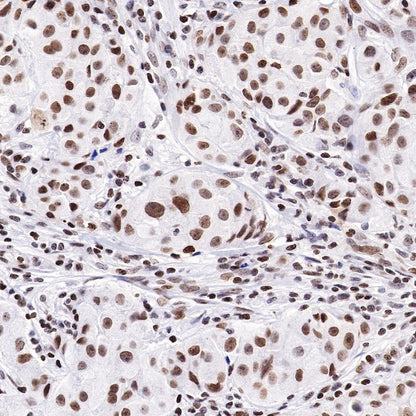 HMGB1 Recombinant Rabbit mAb (S-R305)