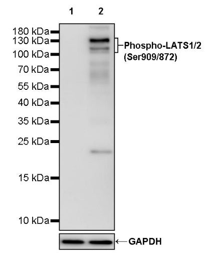 Phospho-LATS1/2(Ser909/872) Recombinant Rabbit mAb (S-1874-69)
