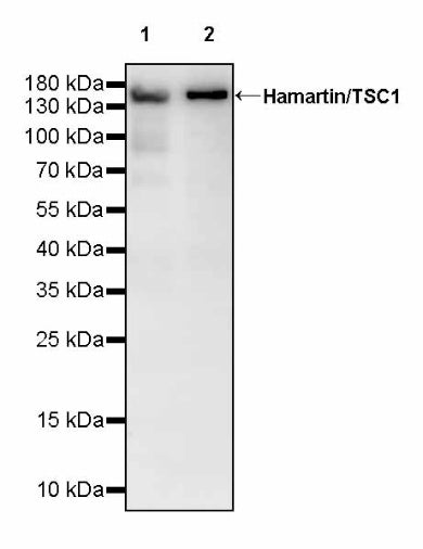 Hamartin/TSC1 Recombinant Rabbit mAb (S-2725-166)