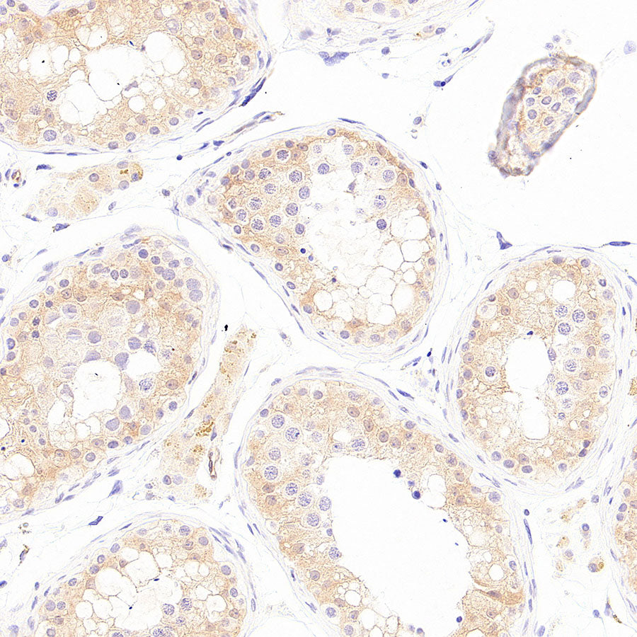 PHD1/prolyl hydroxylase Recombinant Rabbit mAb (S-5060-43)