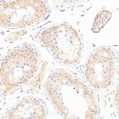 PHD1/prolyl hydroxylase Recombinant Rabbit mAb (S-5060-43)