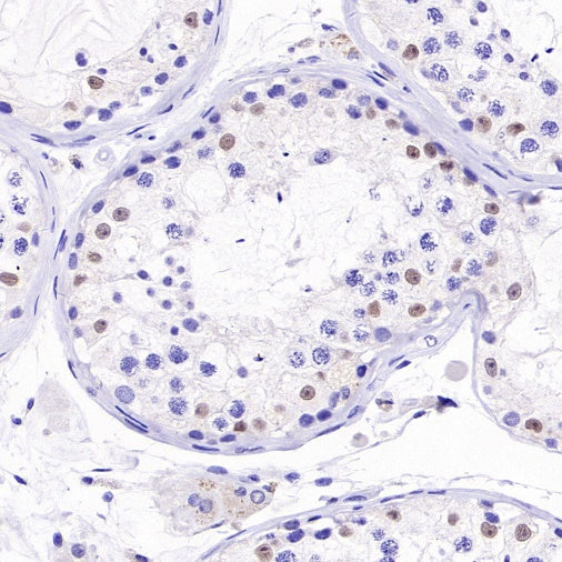 NKX3.1 Recombinant Rabbit mAb (S-2778-63)