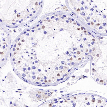 NKX3.1 Recombinant Rabbit mAb (S-2778-63)