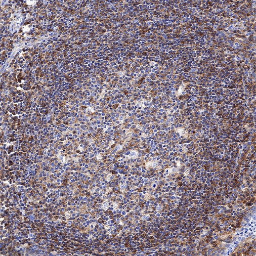 HLA-E Recombinant Rabbit mAb (S-1081-62)