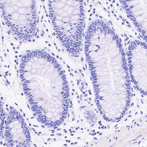 MUC5AC Recombinant Rabbit mAb, PBS Only (SDT-2630-23)