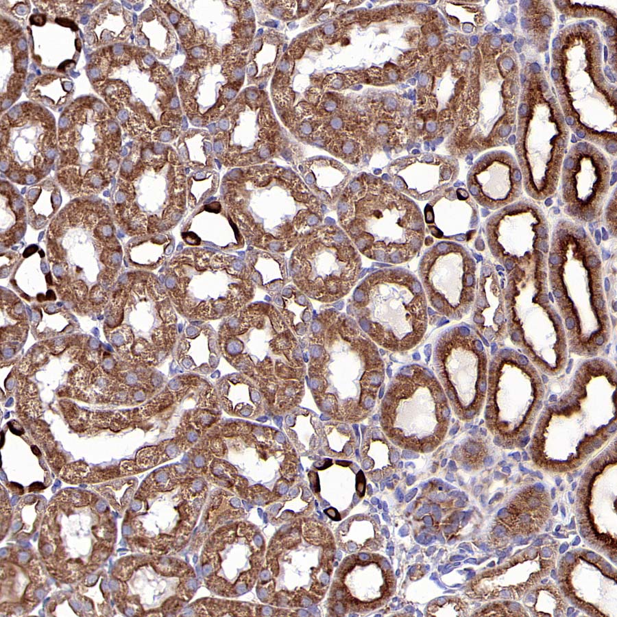 RPS3 Recombinant Rabbit mAb (S-4121-27)