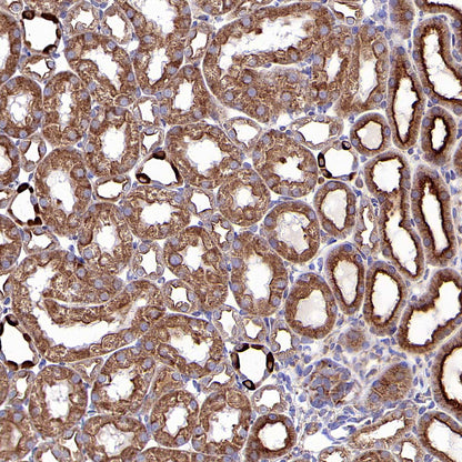 RPS3 Recombinant Rabbit mAb (S-4121-27)